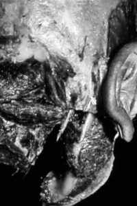 proformed formations médicales, podologie et anneau pelvien